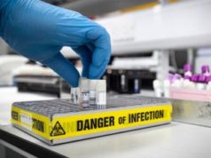 COVID-19 : tous les pays africains désormais capables d’effectuer des tests en laboratoire